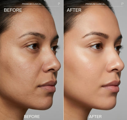 Before and after images showing improved skin texture using the ordinary multi-peptide serum for hair density by SknMaxxing